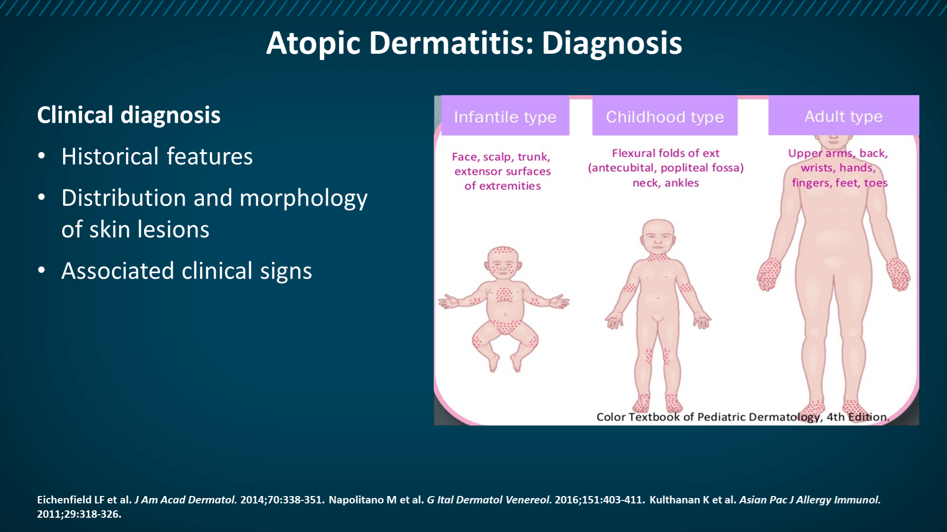 Atopic Dermatitis: Overview of Current Diagnosis – Atopic Dermatitis